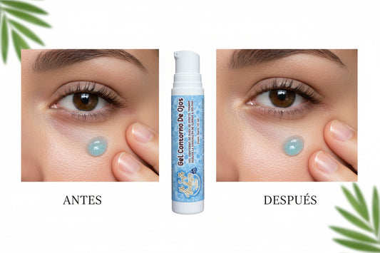 Gel contorno de ojos